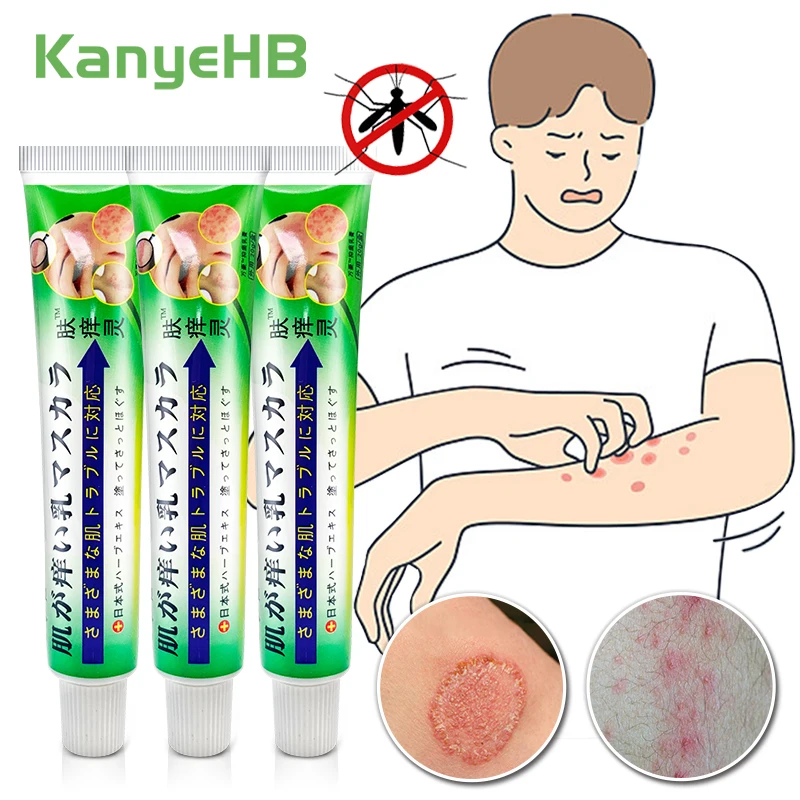 

3pcs Herbal Skin Anti-itch Ointment Anti-fungus Relief Itch Psoriasis Medical Plaster Dermatitis Eczema Treatment Cream A1687