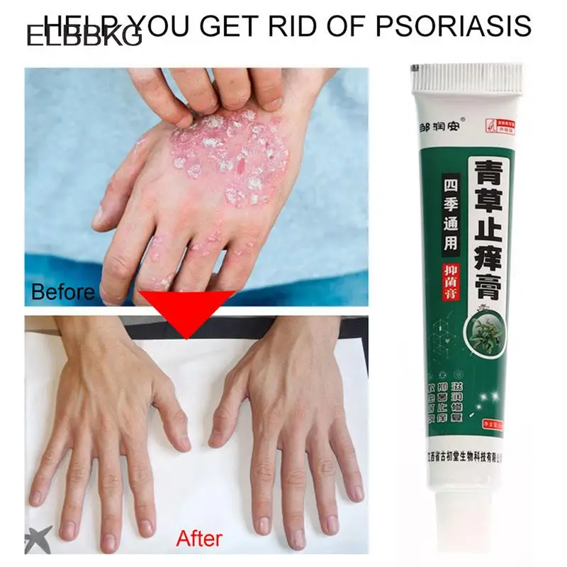 

1 шт., антибактериальный крем для лечения экземы