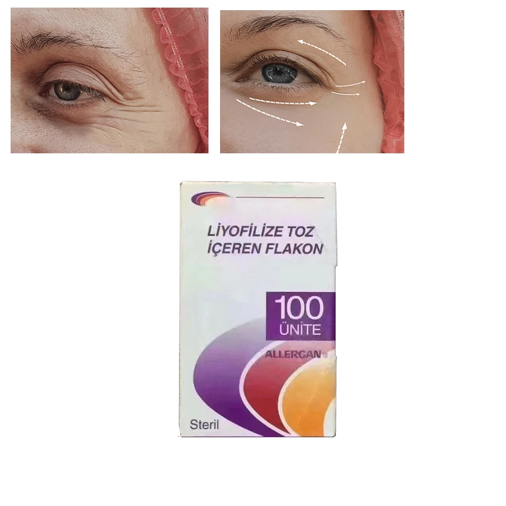 

Original Purple 100 unit Type A Anti-wrinkle Beauty Skin