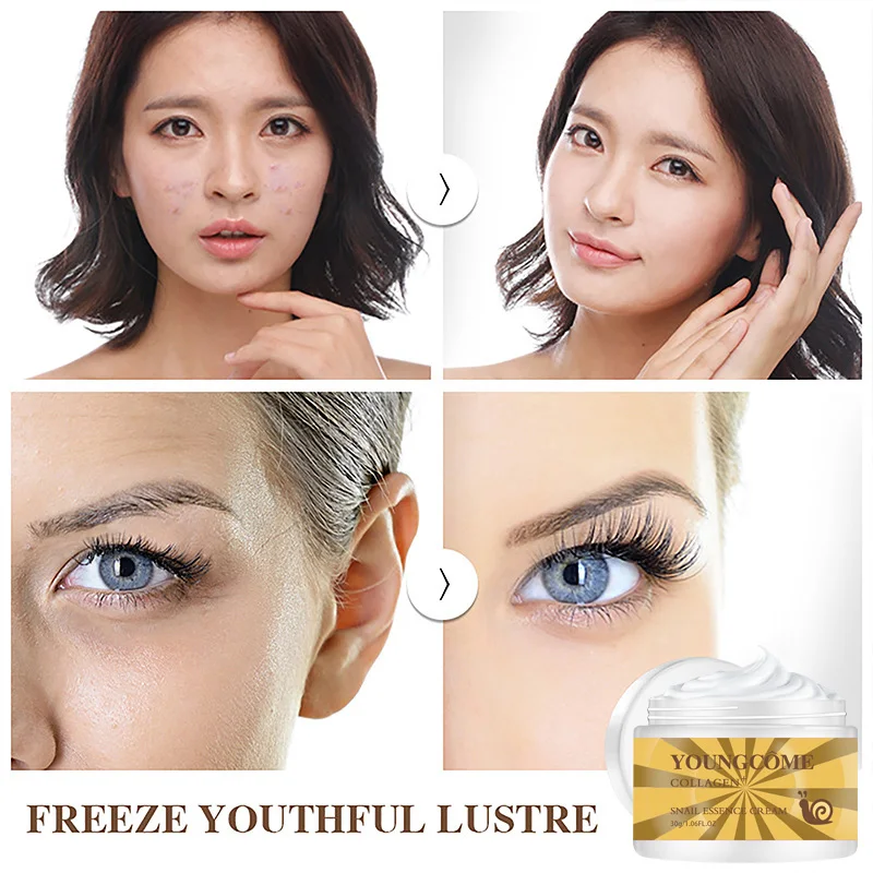 YOUNGCOME лицо улитки коллагеновый крем отбеливающий увлажняющий антивозрастной