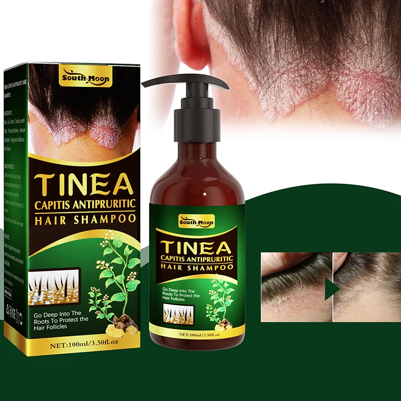 

Scalp moss anti-itching shampoo refreshing and repairing scalp cleaning dandruff removal hair oil control anti-itching hair care