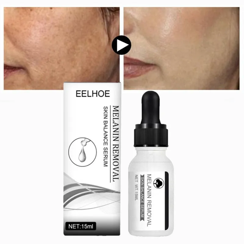 

Whitening Remove Freckle Face Serum Fade Dark Spots Melasma Melanin Facial Essence Brighten Moisturizer Acne Treatment Skin Care