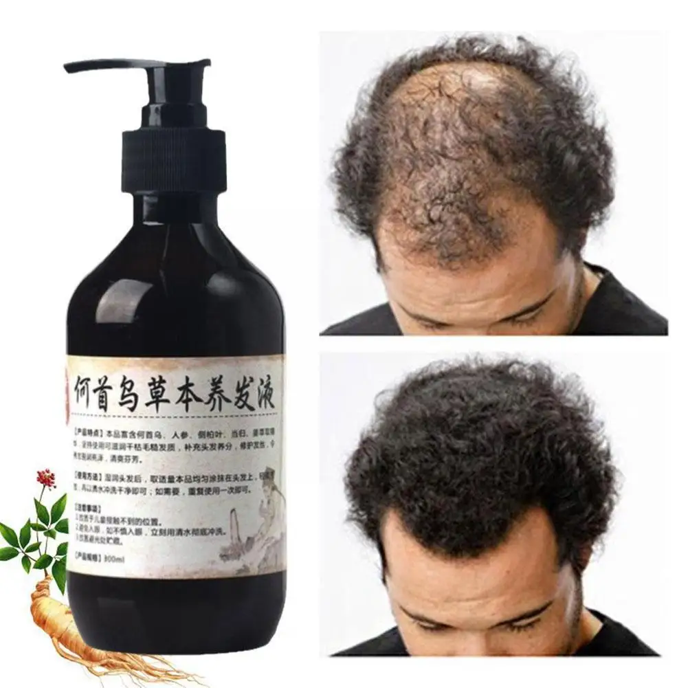 

New Polygonum Multiflorum Shampoo Herbal Shampoo Plant Moisturizing Repair Damaged Hair Care Nutrition S4R1