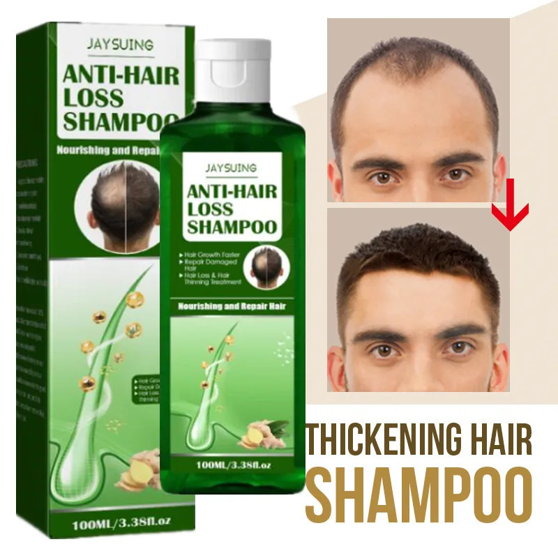 

Натуральный профессиональный шампунь для волос с имбирем 100 мл, быстрый и плотный шампунь для роста волос, продукт против выпадения волос