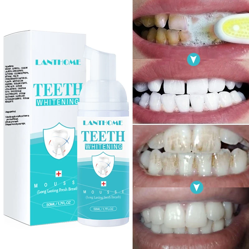 

Mousse Foam Teeth Whitening Strong Decontamination Brightening Yellow Teeth Reducing Halitosis Refreshing Breath Tooth Care 50ml