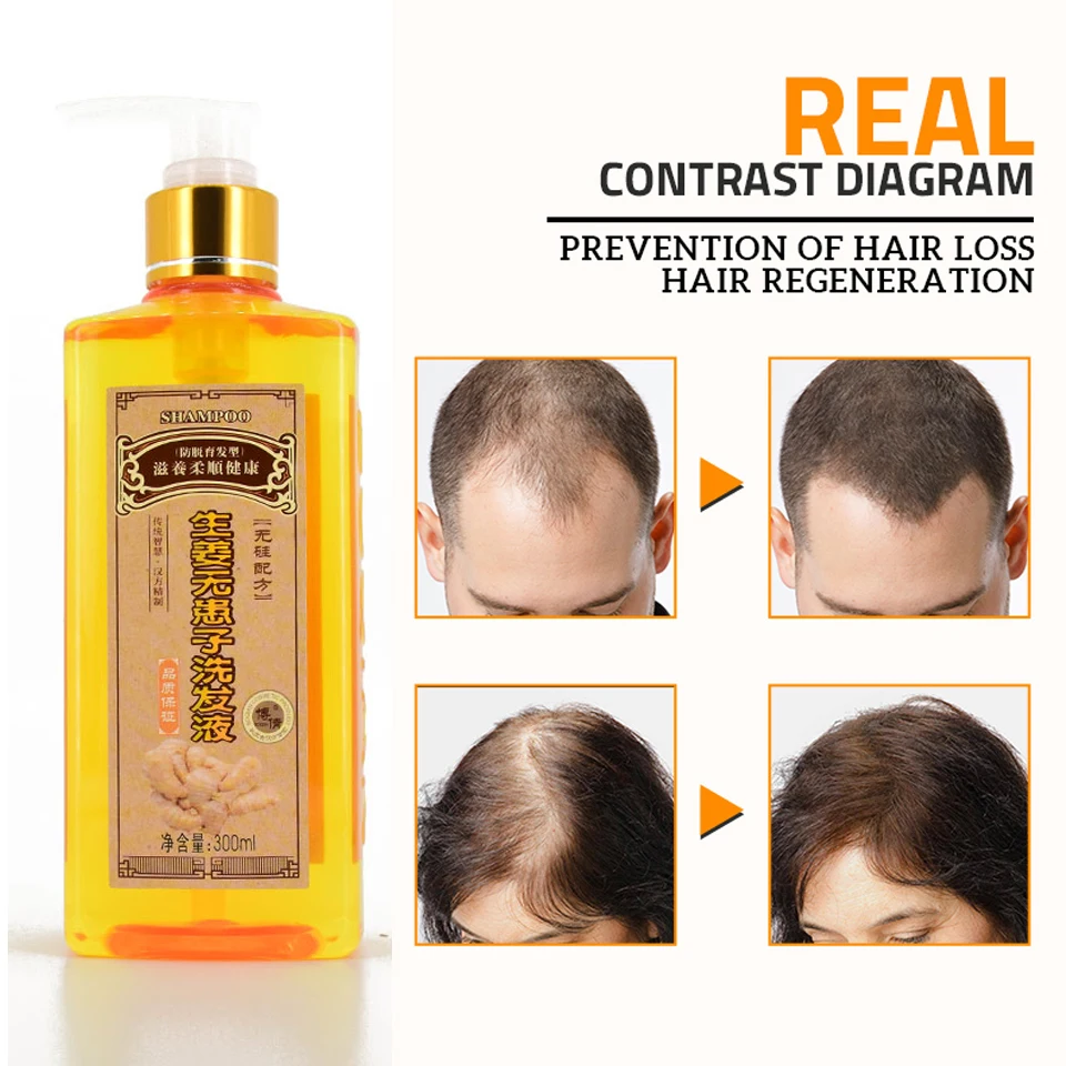 2pcs 300ml Genuine Professional Hair ginger Shampoo 300ml, Hair regrowth Dense Fast, Thicker, Shampoo Anti Hair Loss Product