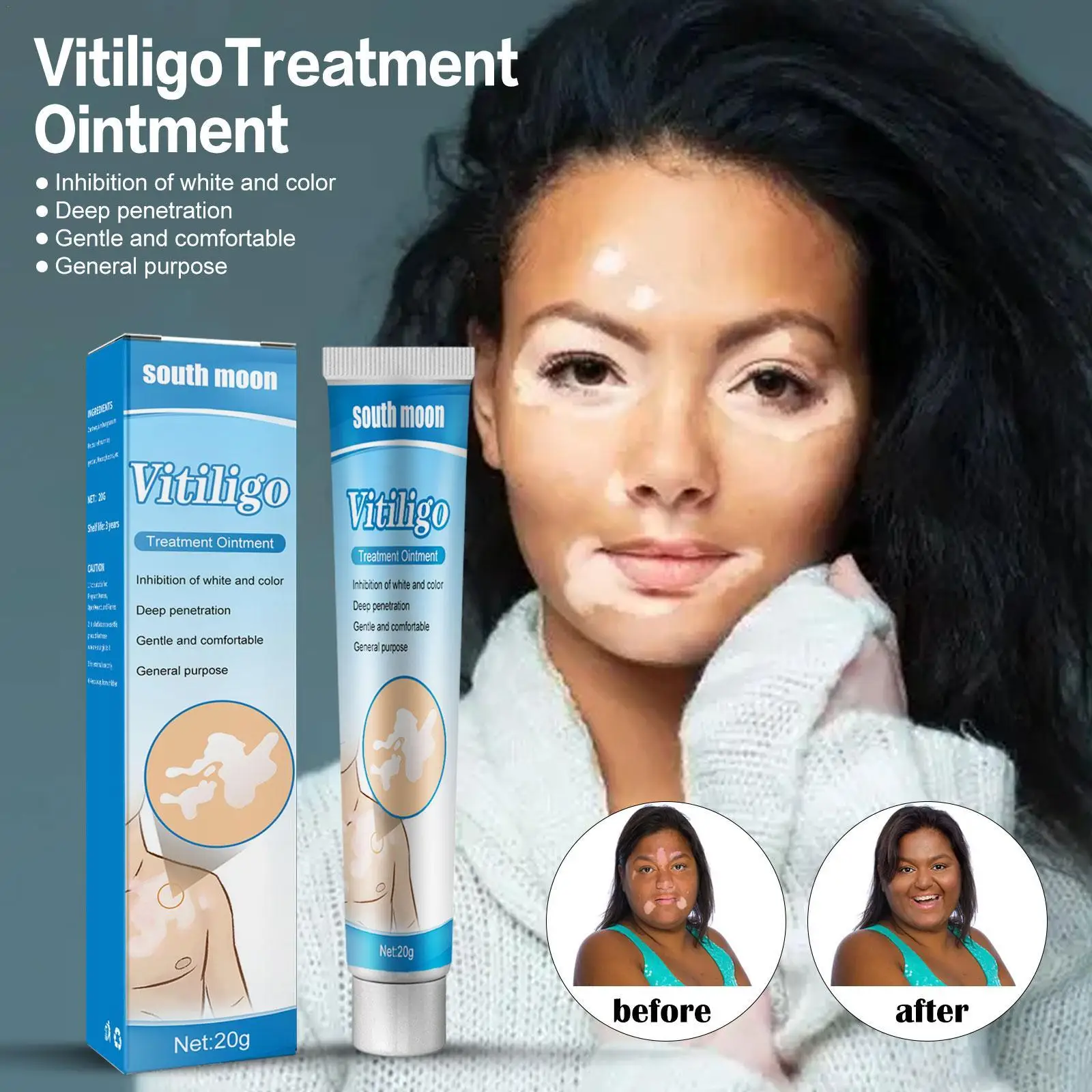

20g Treatment Moisturizing Cream White Spot Disease Vitiligo Balm Repair Ointment Treatment Moisturizing Cream Body Care Cream