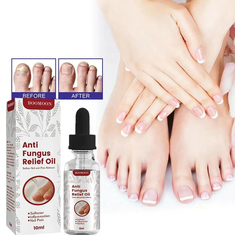 

10ml Anti Fungus Relief Oil Toe Nail Ingrown Corrector Stop Pain Onychomycosis Treatment Serum Toe Corrector