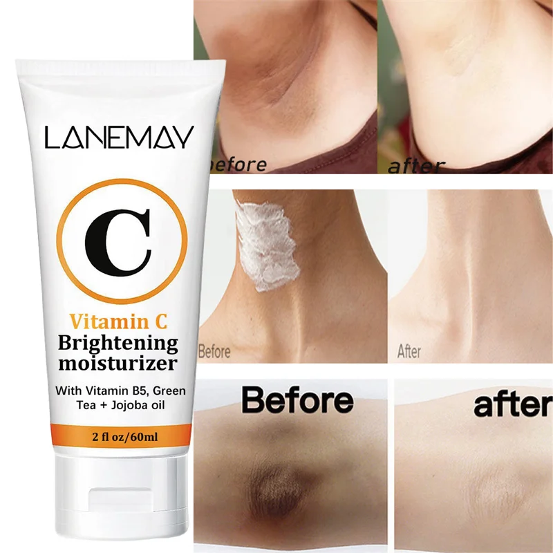 

Whitening Body Cream Underarm Bleaching Cream Whitening Buttock Knee Brightening Inner Thigh Black Spot Remove Melanin Skin Care