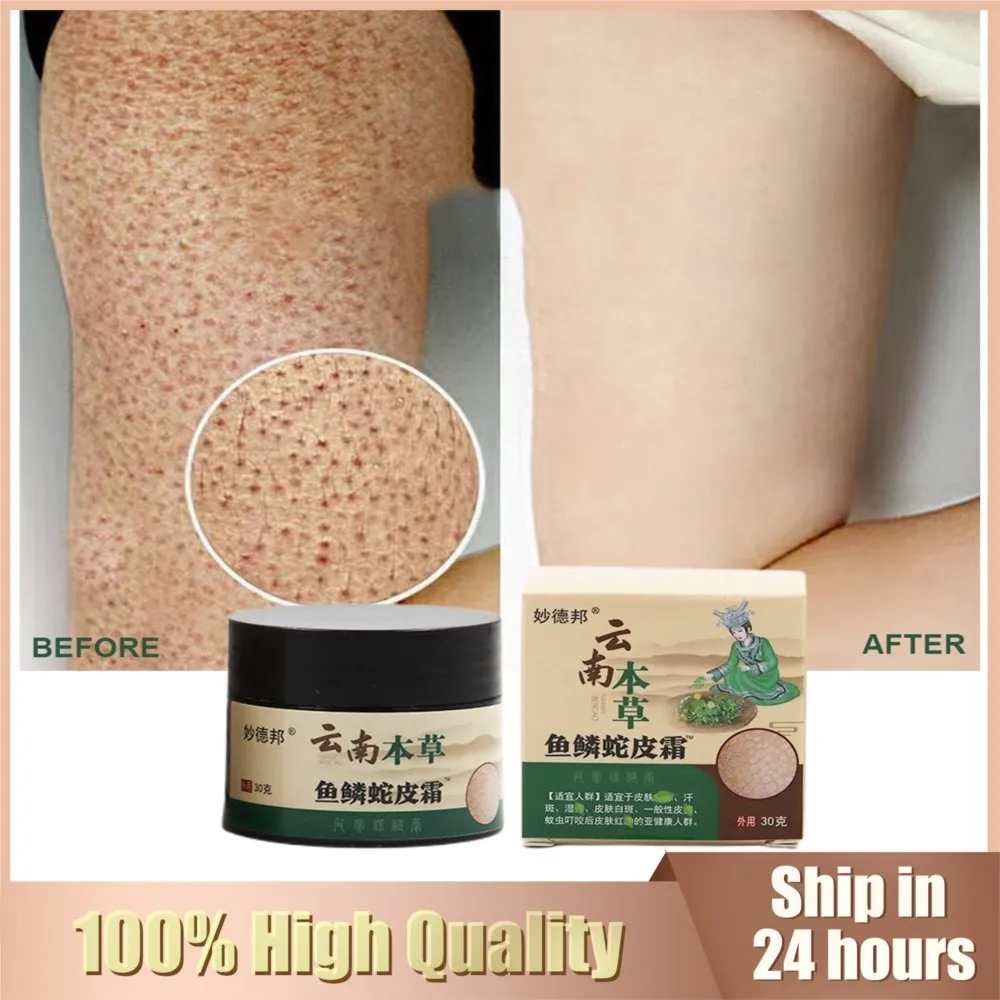 

Repair Chicken Skin Cream Curing Body Dark Spot Keratosis Follicle Pilari Remove Thick Pore Moisturizing Smooth Essence Lotion