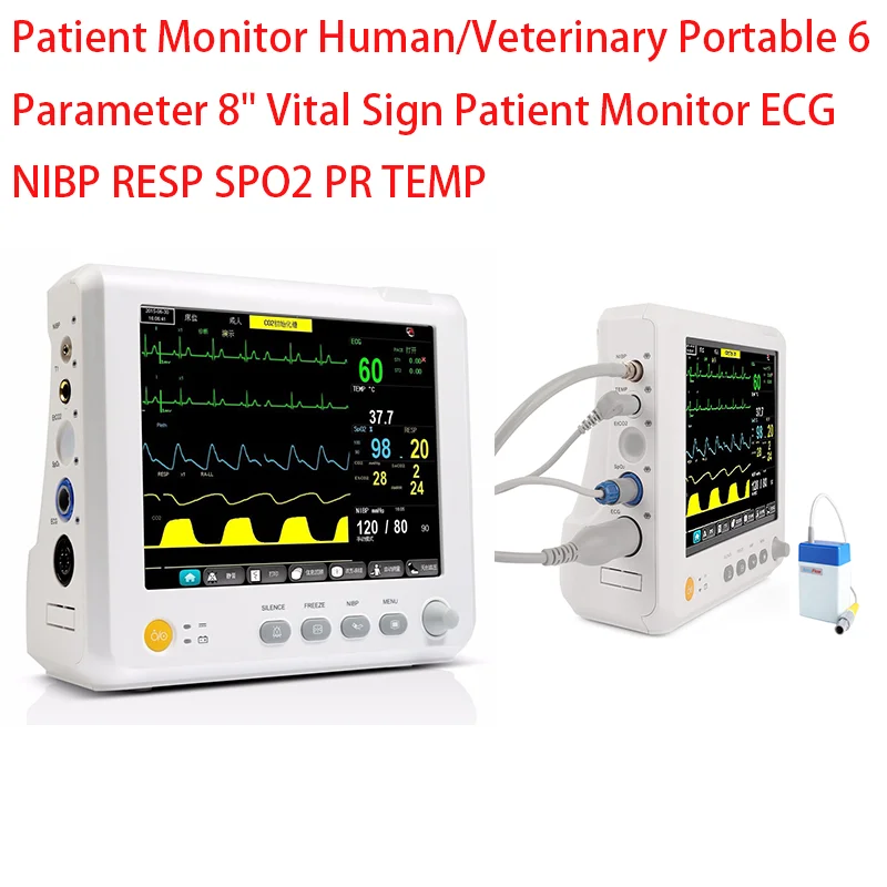 

8.4 inch screen portable 6-parameter new vital signs ECG/NIBP/PR/SPO2 patient monitor medical machine
