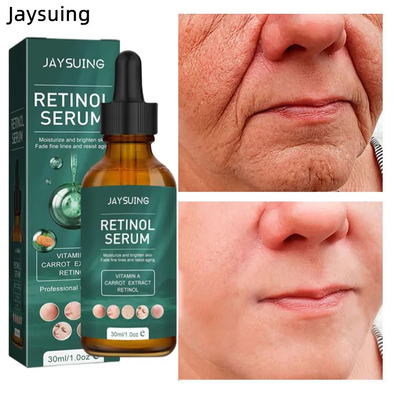 

Средство для удаления ретинола, Сыворотка от морщин, лифтинг, укрепляющий эсенция для лица, коллаген, антивозрастной, выцветающий, восстанавливающий, подтягивающий уход за кожей