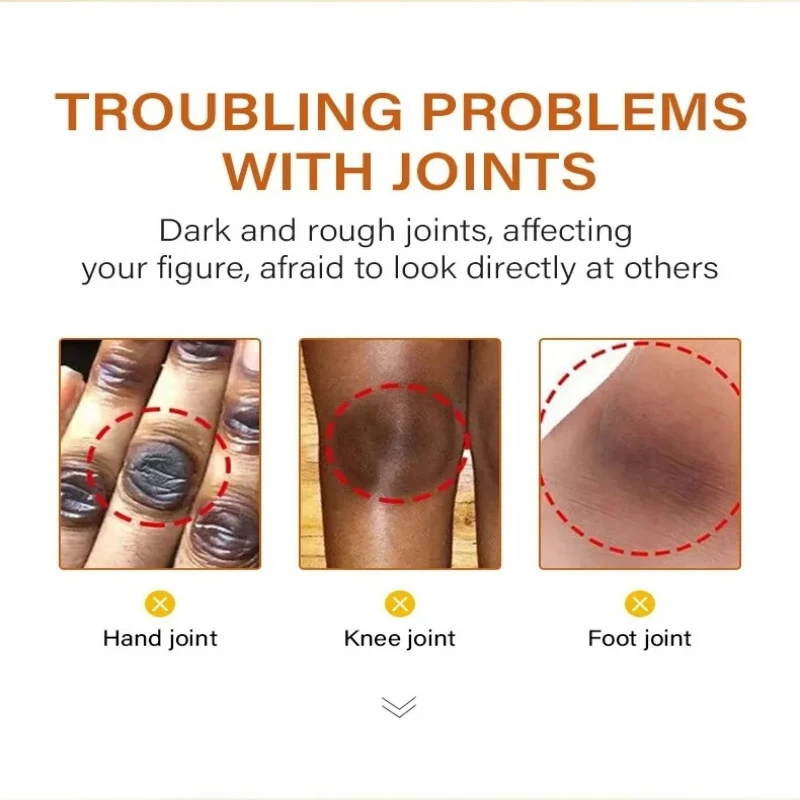 Отбеливающая сыворотка осветляет суставы пальцы локти колени улучшает кожу тела