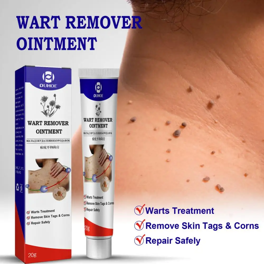 

Skin Tag Warts Remover Ointment Against Mole Cream Fast Removal Genital Wart Acne Spot Treatments Anti Foot Corn Skin Care Cream