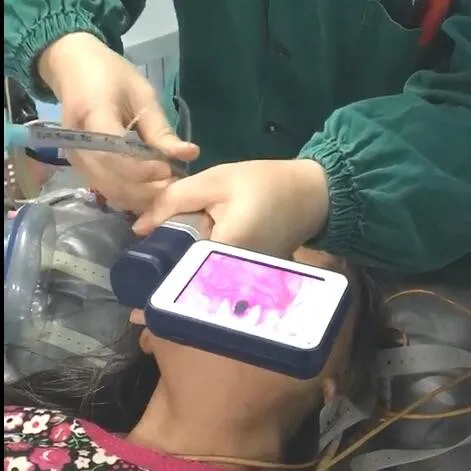 Недорогой многоразовый видеоларингоскоп для управления дыхательными путями