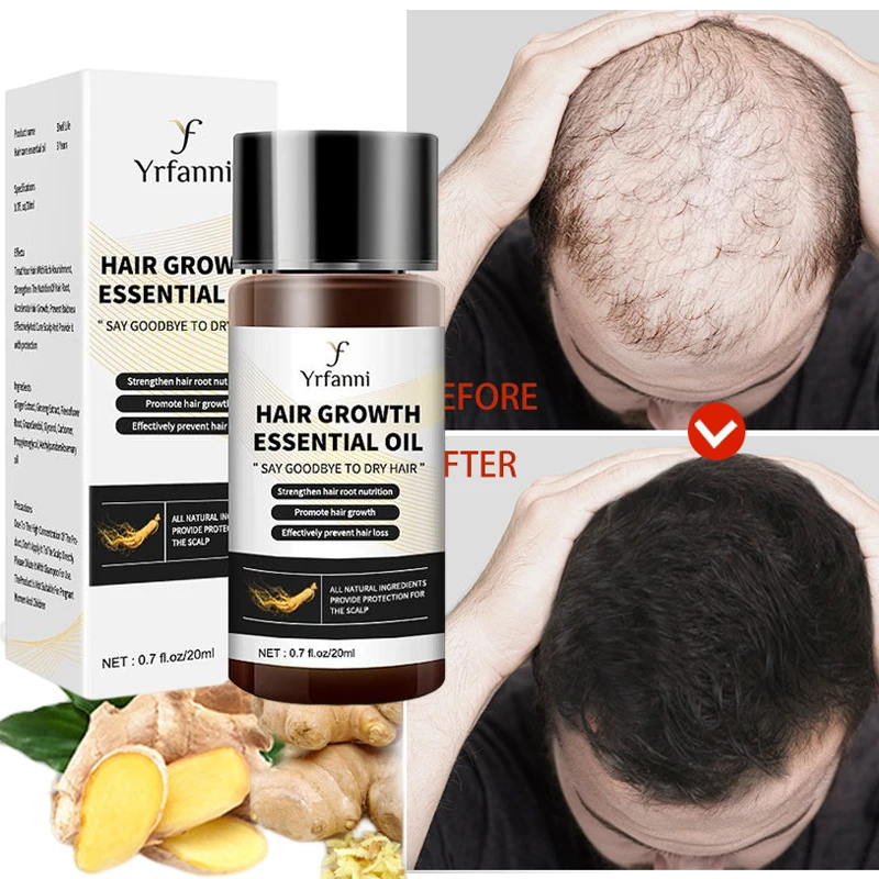 

Ginger Hair Growth Essential Oil Anti Hair Loss Fast Regrowth Prevent Baldness Serum Scalp Repair Treatment Products Men Women