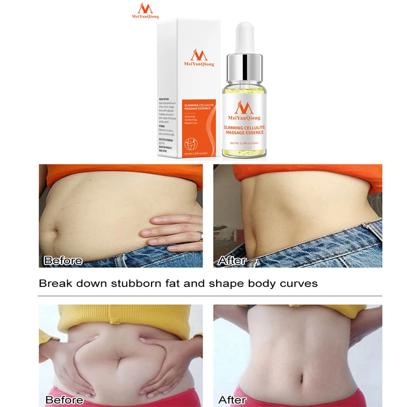 

MeiYanQiong аромат эфирные масла для похудения чистый натуральный жир уменьшение тела скульптурный чистый растительный экстракт Массажная эссенция для женщин