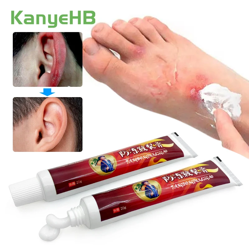 

1pc Chilblain Cream Prevent Skin Cracked Anti-drying Anti-freeze Heel Feet Moisturizing Relieve Skin Peeling Repair Cream S101