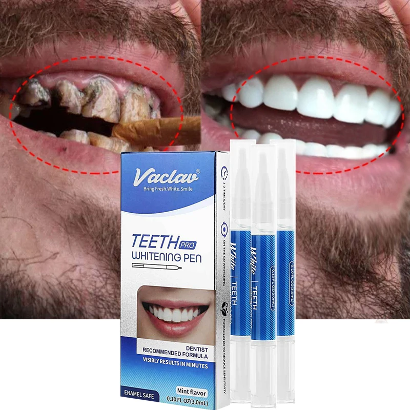 New Teeth Whitening Serum Pen Effective Bleach Brighten Tooth Essence Remove Plaque Stains Oral Hygiene Cleaning Beauty Health