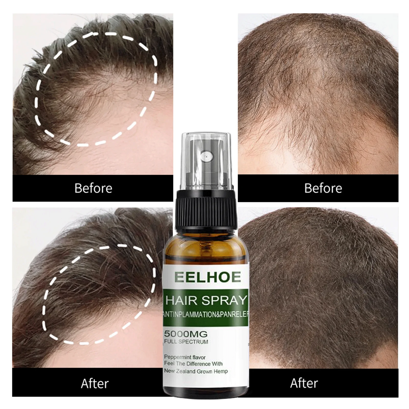 Эссенция для быстрого роста волос спрей мужчин женщин предотвращения выпадения