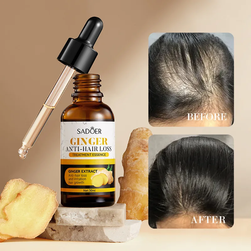 Ginger Anti Hair Loss Essence Fast Hair Growth Oil Strong Hair Roots Serum Repair Nourish Hair Regrowth Thicken Scalp Care 30ml
