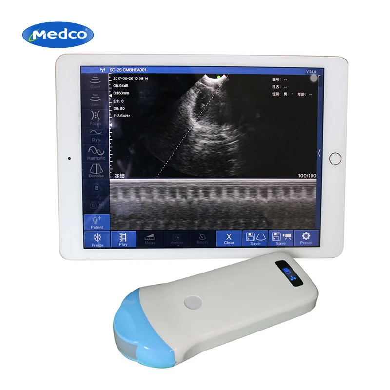 

128 Elements WiFi Ultrasound Sacanner Wireless Micro convex probe