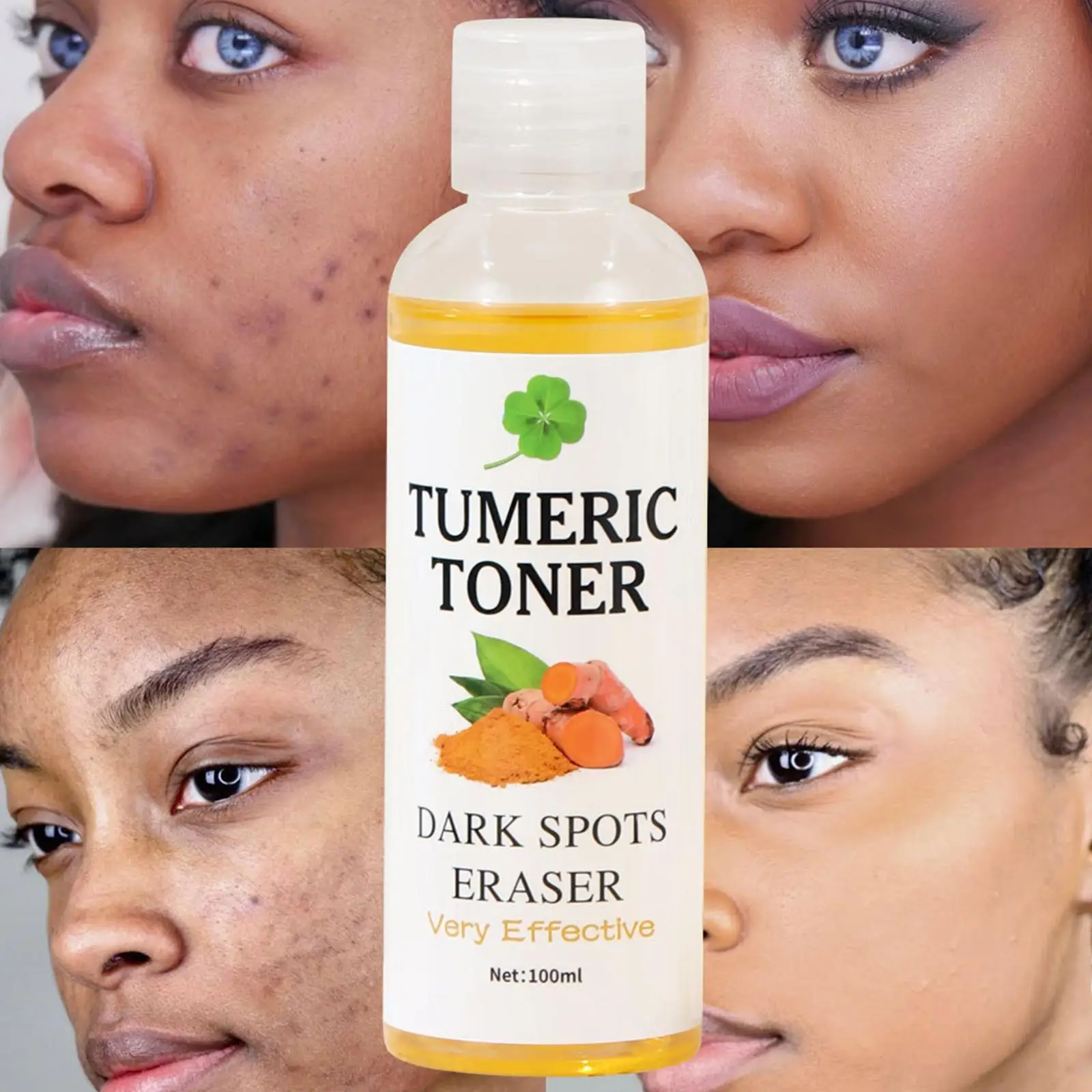 

100ml Tumeric Dark Spots Toner Spots Eraser Corrector Turmeric Fade Blemishes Dark Spot Remover Acne Remover Toner for Dark Skin