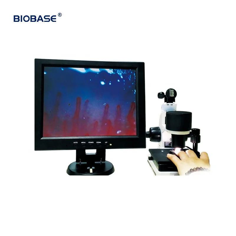 

BIOBASE China Nailfold Video Capillaroscope Detection Instrument Blood Capillary Microcirculation Microscope