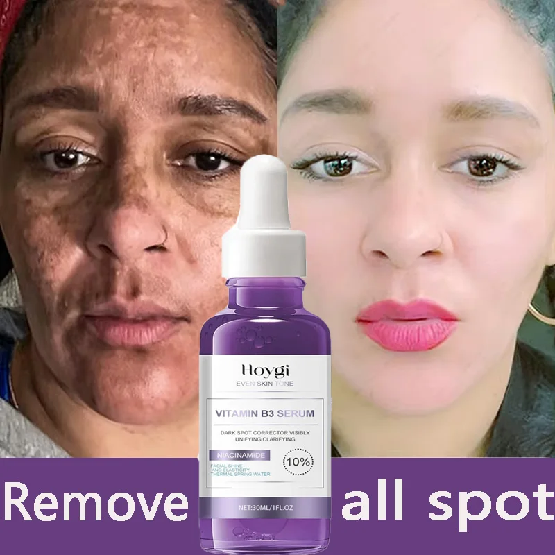 Сыворотка для удаления темных пятен, осветляющая, корейская дневная и ...