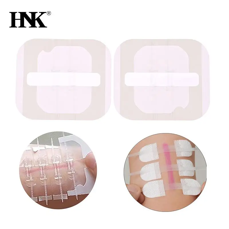 

1/2/3 шт./коробка, пластырь на молнии