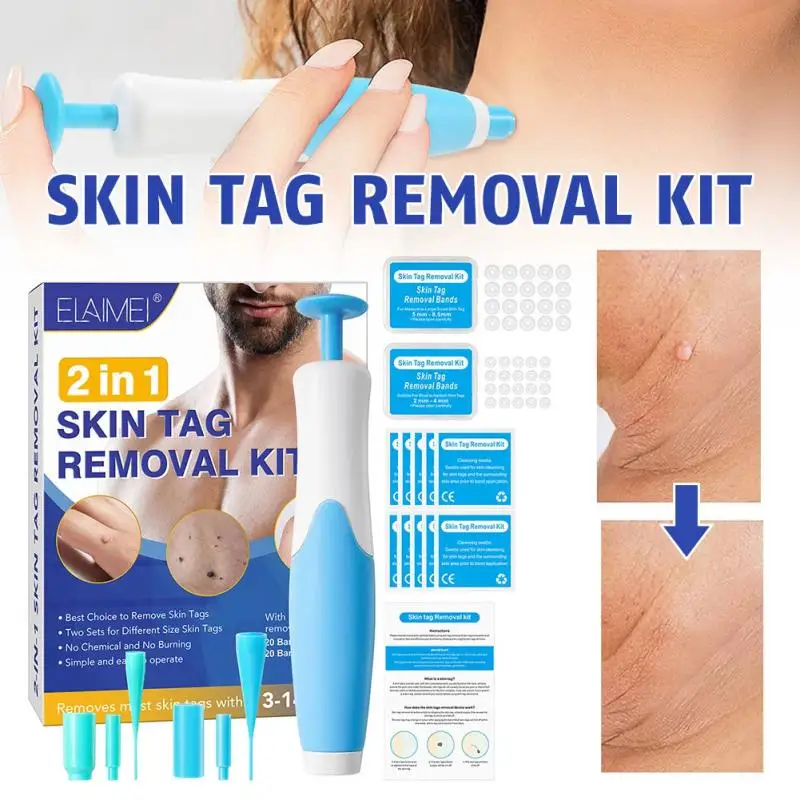 Double Headed Wart Removing Pen Set Auto Skin Tag Remover Painless Mole Wart Remover Skin Tag Removal Kit Skin Care Beauty Tool