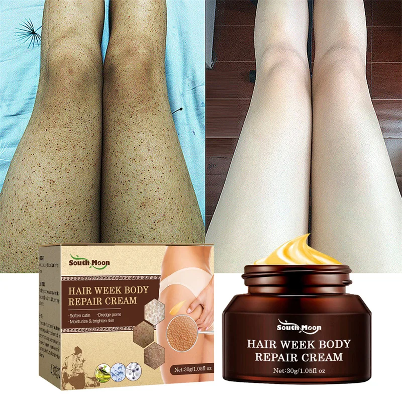 

Keratosis Pilaris Skin Repair Cream Hair Follicle Keratin Remove Body Dark Spot Brighten Smooth Skin Moisturizing Lotion