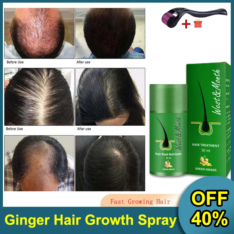 

30ml Ginger Hair Growth Spray Essential Oils Hair Loss Treatment Fast Grow Prevent Hair Dry Frizzy Damaged Thinning Repair Care