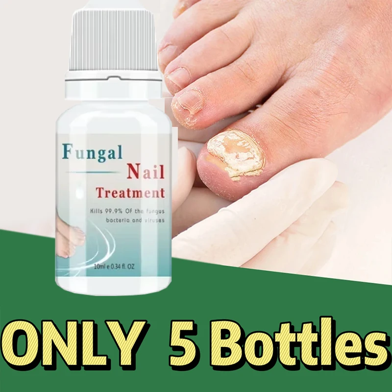 Новое лечение грибка ногтей для силового восстановления на ногах увлажняет