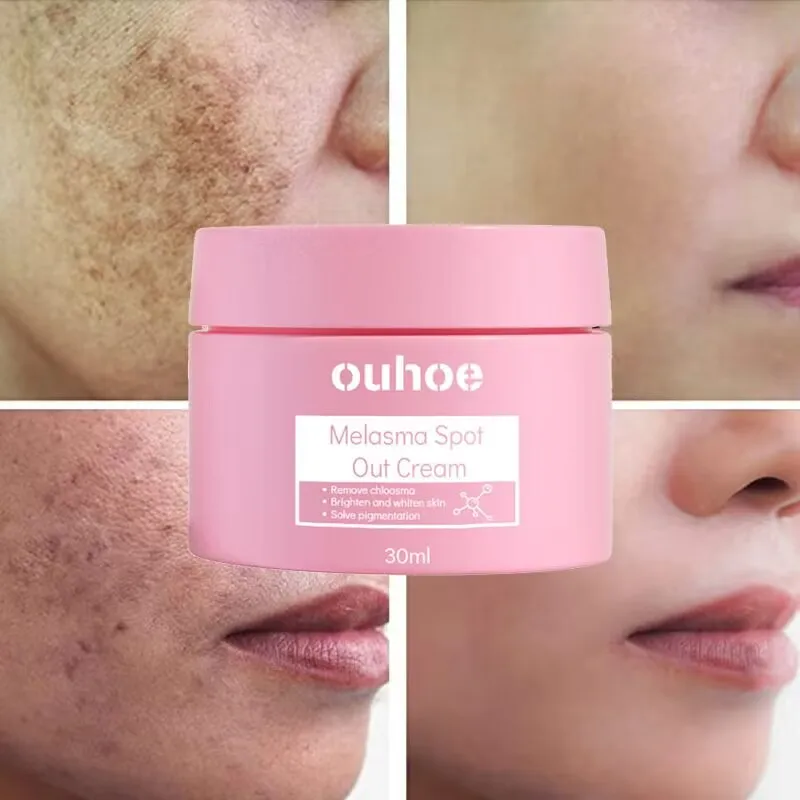 Effective Whitening Freckles Cream Remove Melasma Melanin Fade Dark Spots Firm Anti-Aging Brighten Moisturizing Beauty Skin Care