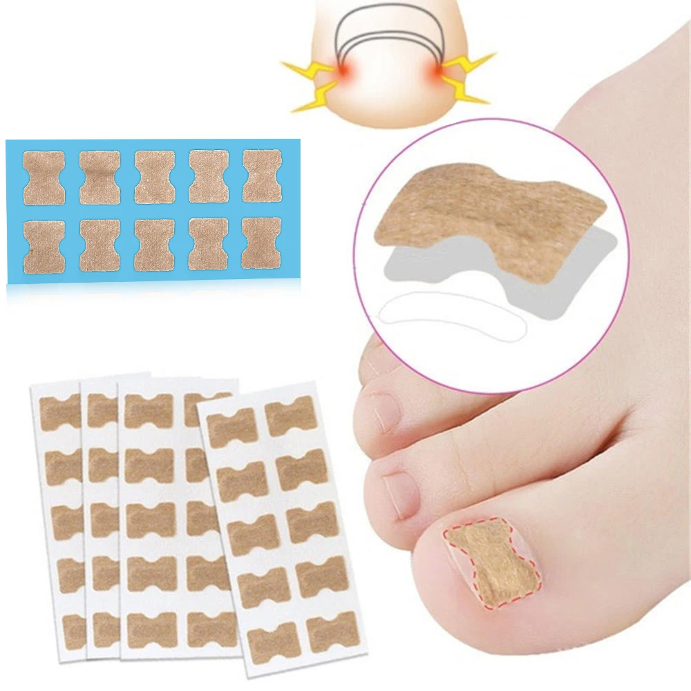 

Ingrown Toenail Corrector Sticker Paronychia Recover Toenail Elastic Patch Corrector Paronychia Treatment Fixer Toe Nail Tool