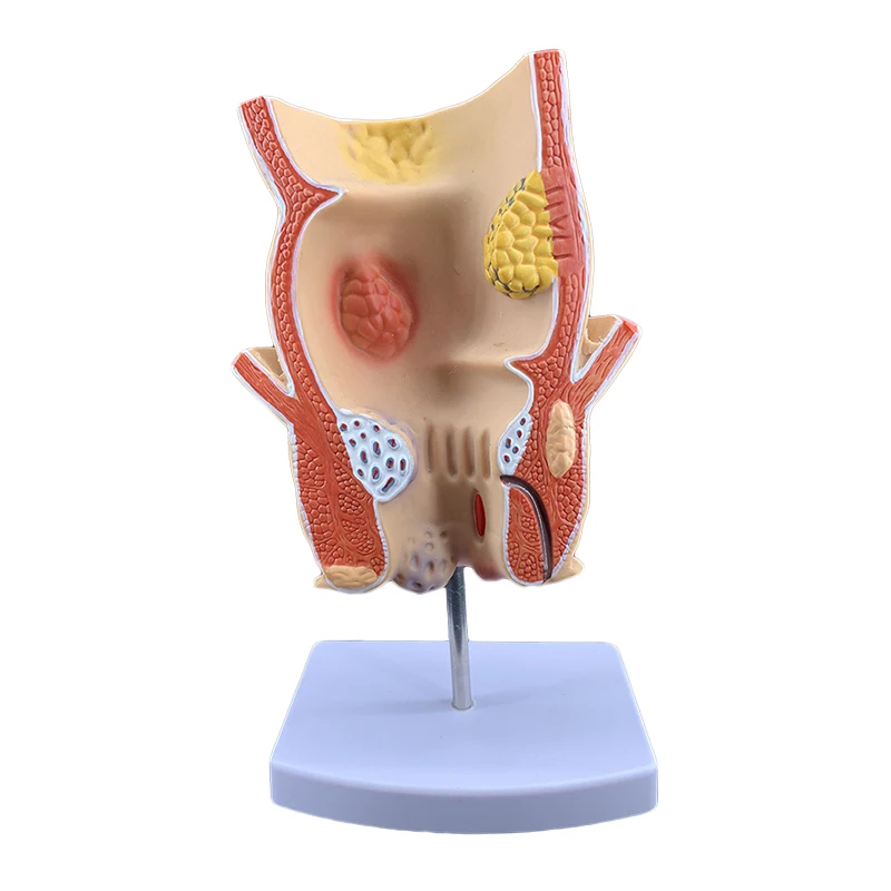 

Анатомическая модель прямой кишки PLLCUTE