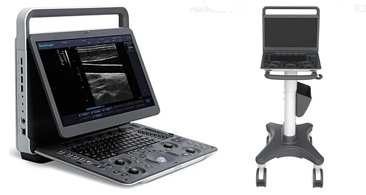 Рисунок 2 - Sonoscape E2V, большая портативная
