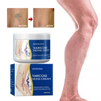 vein repair cream relieve swelling earthworm leg blue veins bulge nourish vasculitis phlebitis improves legs massage cream 50g