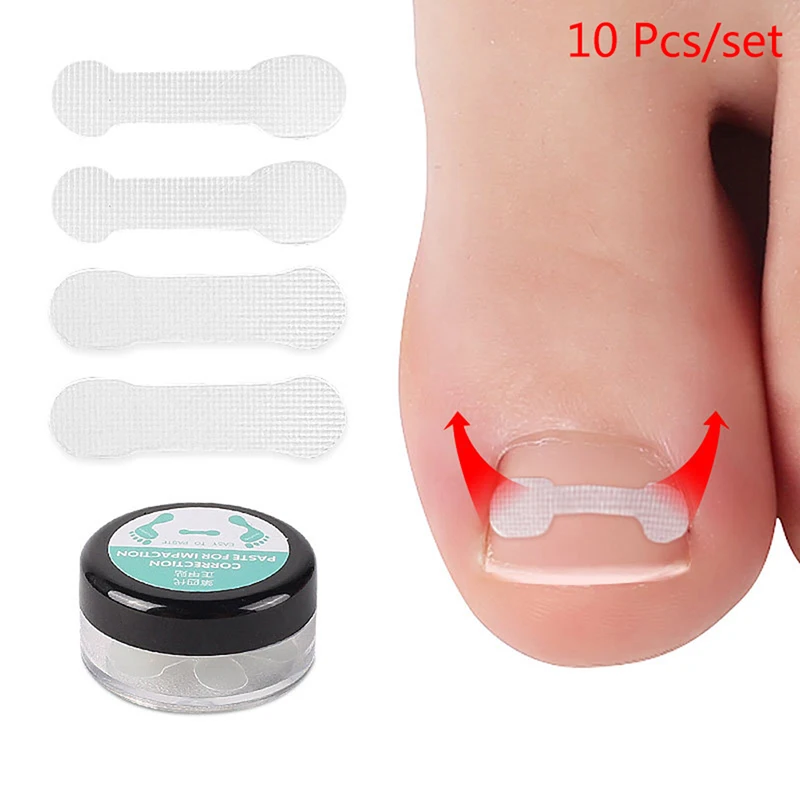 

10pcs/box Ingrown Toe Nail Correction Sticker Patch Paronychia Correction File Acronyx Wire Corrector Foot Care Treatment