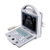 ysb5600 hot selling bw doppler portable ultrasound scanner with competitive price