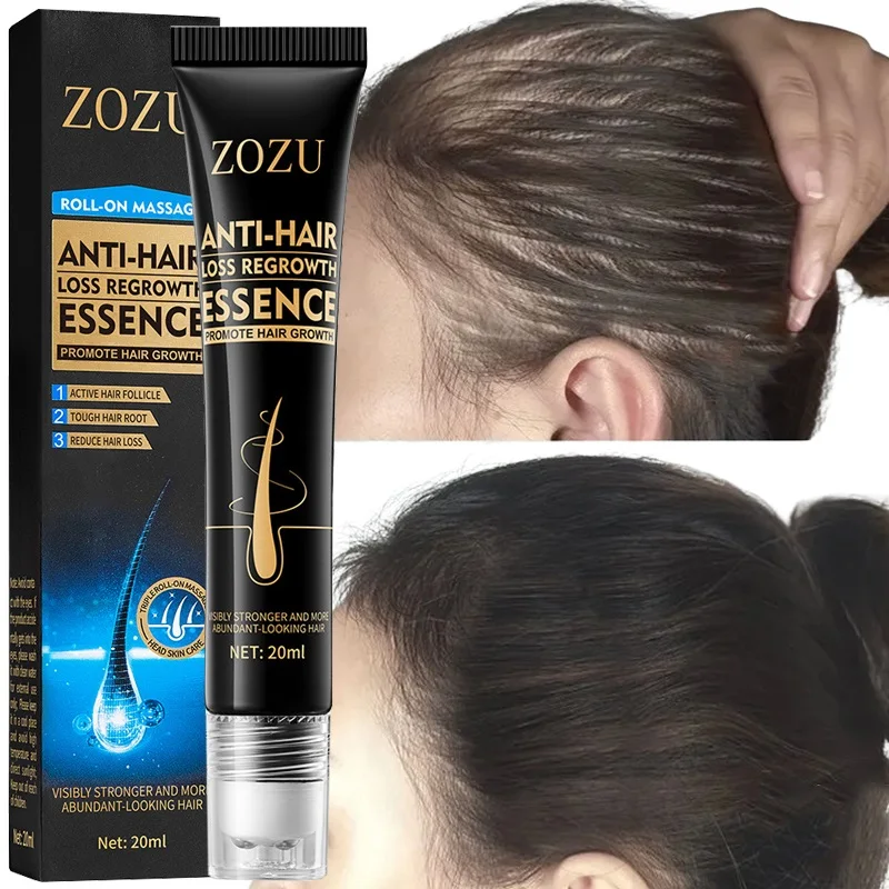 

Эссенция для быстрого роста волос Эффективная Сыворотка против выпадения волос, восстановление облысения, уход за волосами после родов