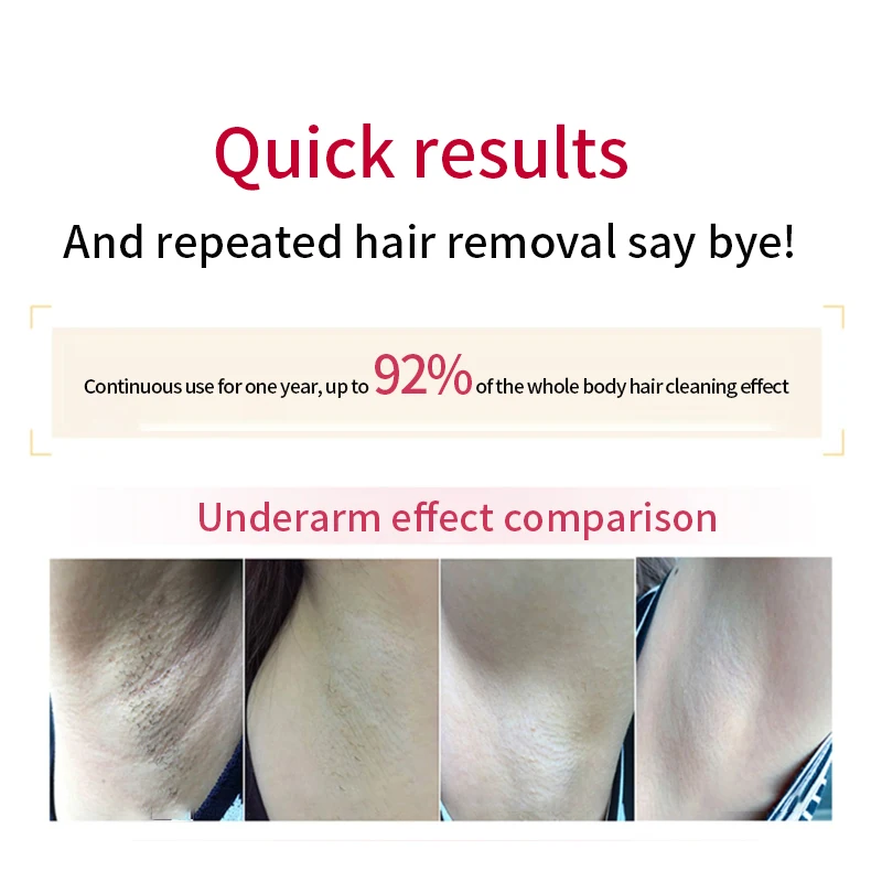 Laser Hair Removal Epilator Malay Depilator Machine Full Body Hair Removal Device Painless Personal Care Appliance  For Women enlarge