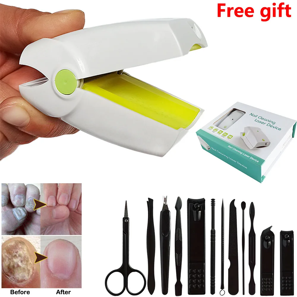 Portable nail laser fungus cold laser nail fungal Infection grey color toenail laser device Nail mushroom treatment