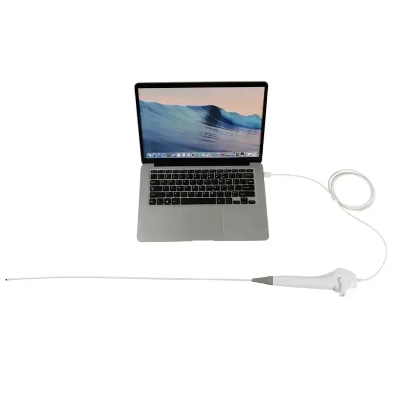 Нософархигоскоп 2024 Китай BESDATA портативный низкая цена гибкая эндоскопия 3 5 мм HD