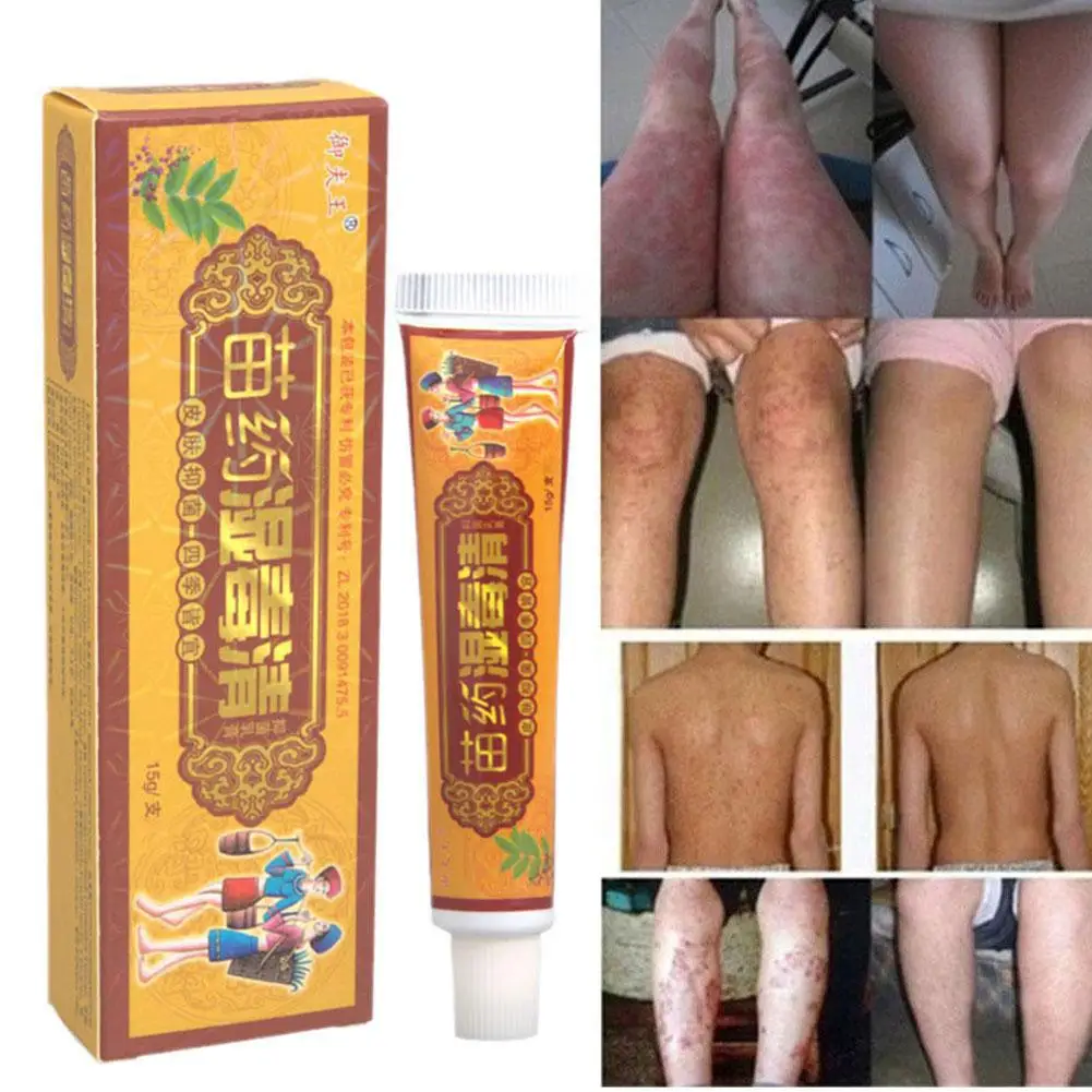 Фото 15 г Yufu Wang Miao Yao Shidu Qing травяной крем для увлажнения и токсичной кожи внешнее использование молочный продукт для ухода за кожей D5j9 №3