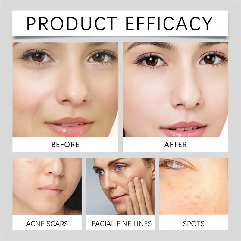 Отбеливающий крем с витамином C мелазма искусственная улучшающая долгий эффект