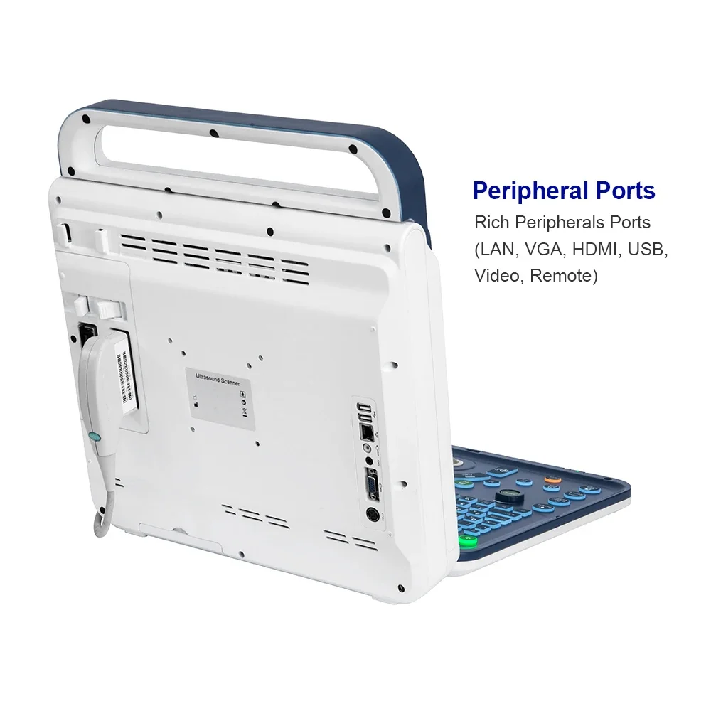 MY-A027E Mayamed портативный ноутбук ecografo ультразвуковой аппарат цветной Доплер сканер