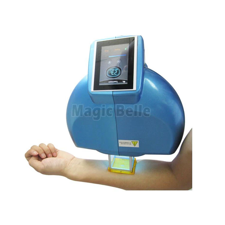 excimer laser psoriasis pharos ex-308nm excimer lasers psoriasis vitiligo treatment excimer 308nm laser