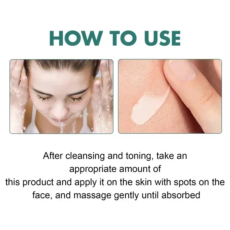 Niacinamide мелазма Осветляющий крем уменьшает меланин осветляет темную кожу хлоазма